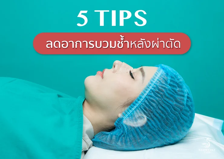5 Tips ลดอาการบวมช้ำหลังผ่าตัด