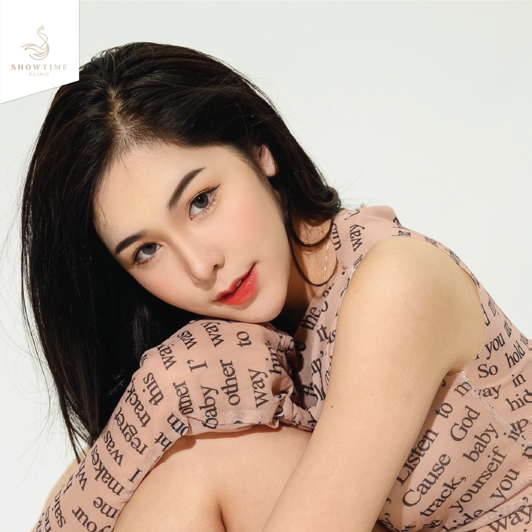 เสริมจมูกแก้ไขโครงสร้าง