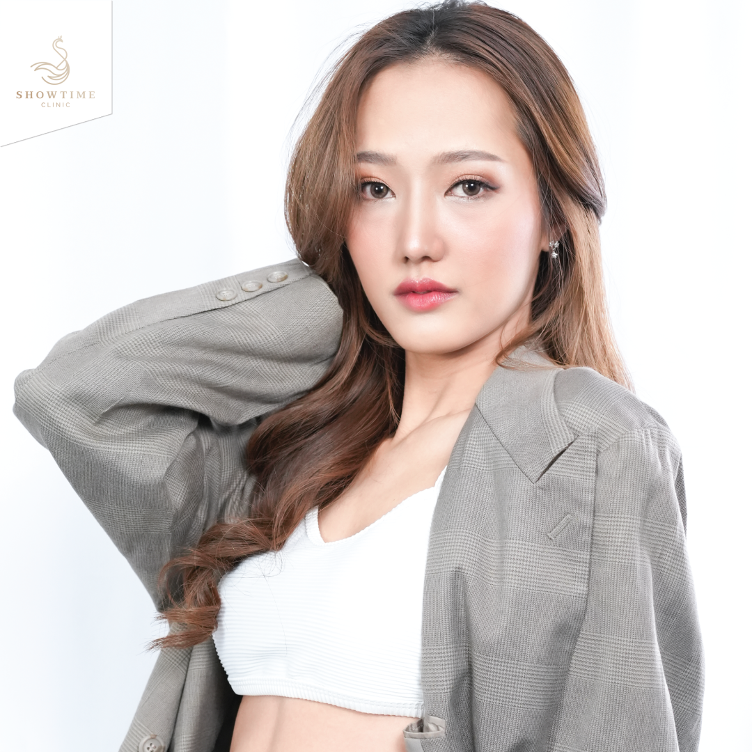 เสริมจมูกแก้ไขโครงสร้าง