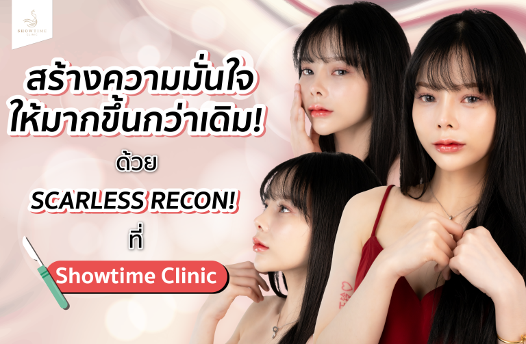 สร้างความมั่นใจให้มากขึ้นกว่าเดิม! น้องอะตอม