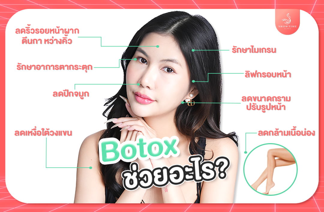 โบท็อก(Botox)