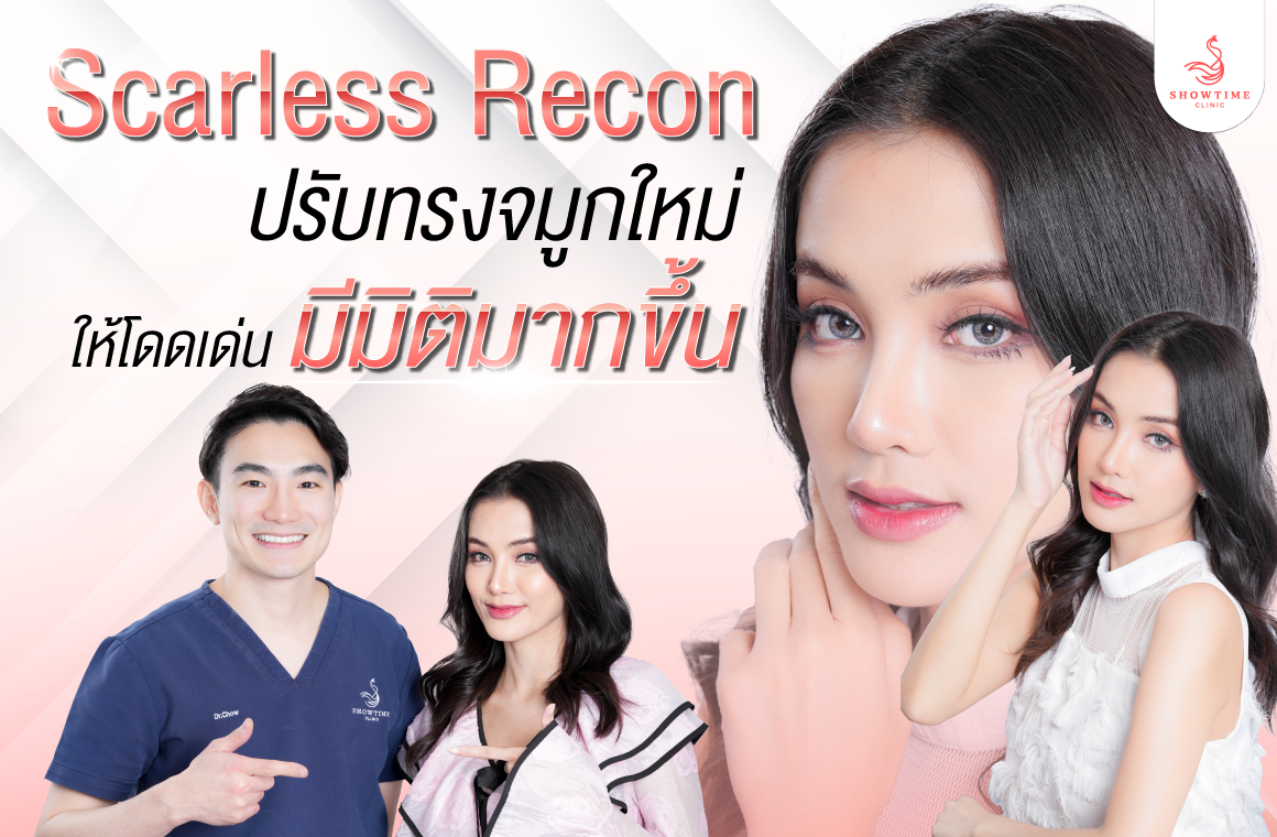 แก้จมูก Scarless Recon – คุณกระเต็น ขอปรับทรงจมูกใหม่ พร้อมเพิ่มมิติบนใบหน้าให้ปังขึ้นกว่าเดิม!