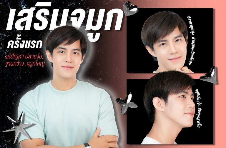 ก็อต – เสริมจมูก แก้จมูกงุ้ม