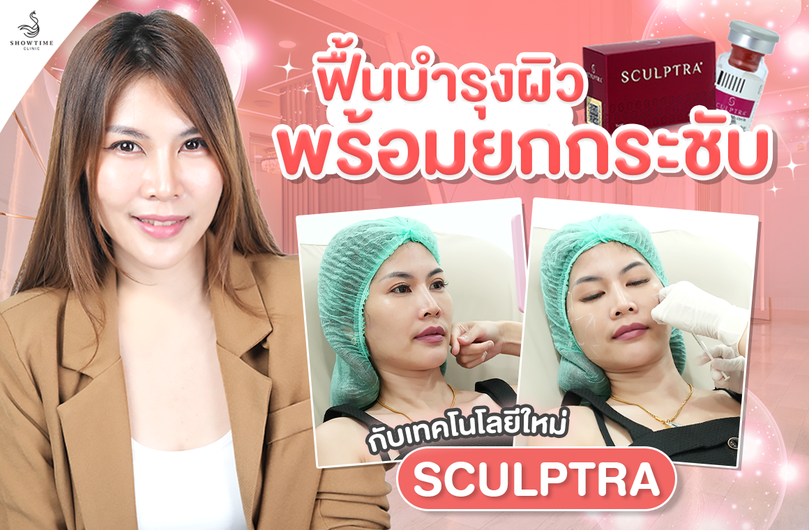  คุณนุ้ย เลือกฟื้นบำรุงผิวพร้อมยกกระชับ กับเทคโนโลยีใหม่ SCULPTRA