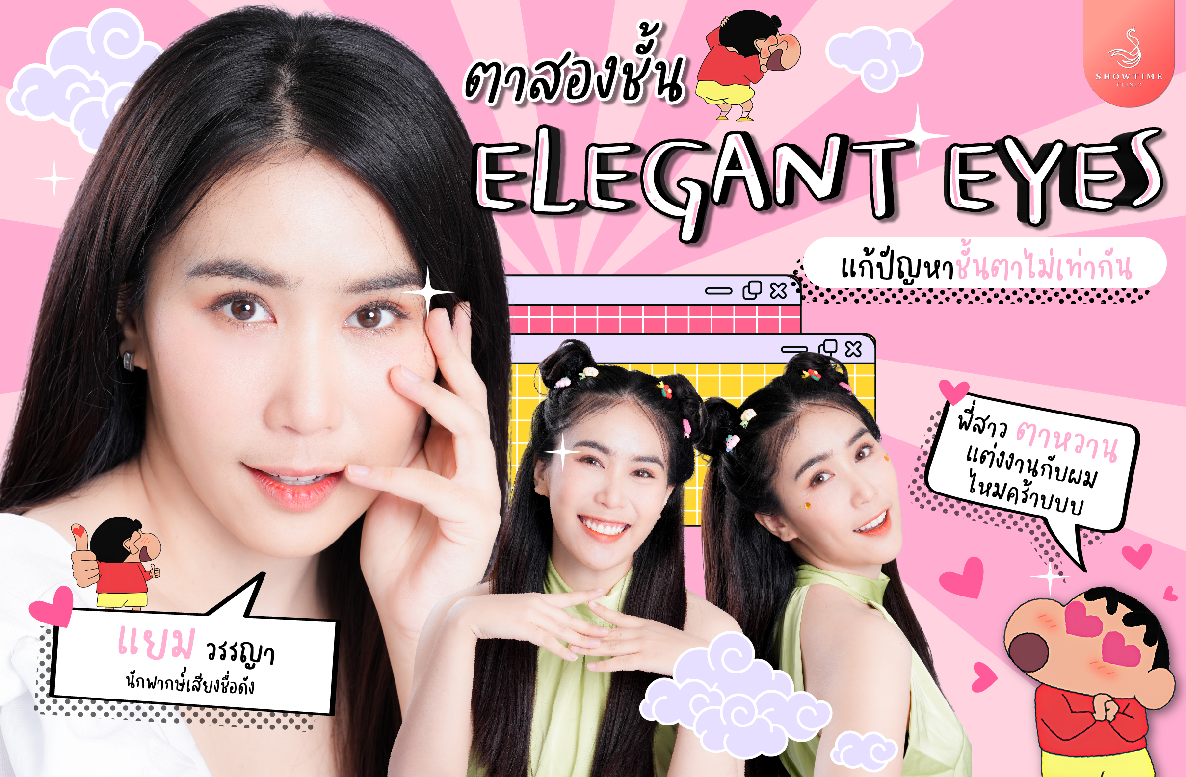 ตาสองชั้น Elegant Eyes กับปัญหาชั้นตาไม่เท่ากัน