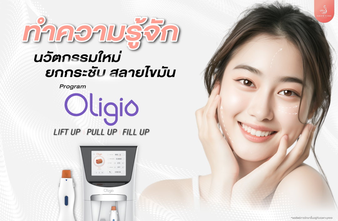 Oligio (โอลิจิโอ)