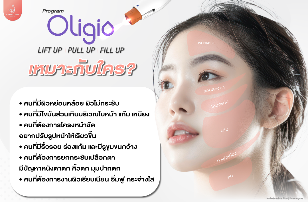 Oligio (โอลิจิโอ)