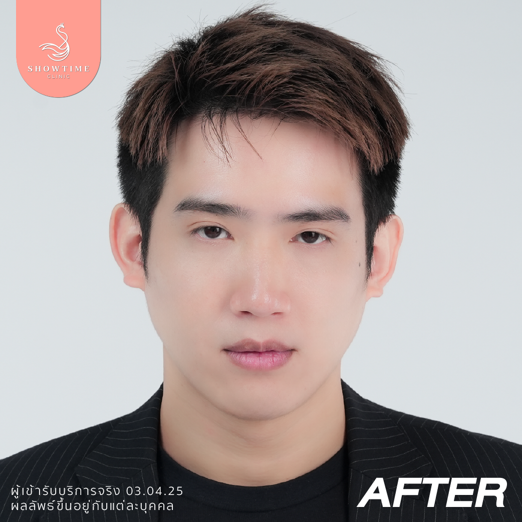 โบท็อก