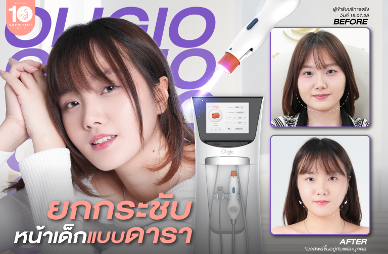 คุณแก้ม รีวิว Oligio ที่ Showtime Clinic กับคุณหมอแนน – ยกกระชับหน้าเด็กแบบดาราในปี 2025