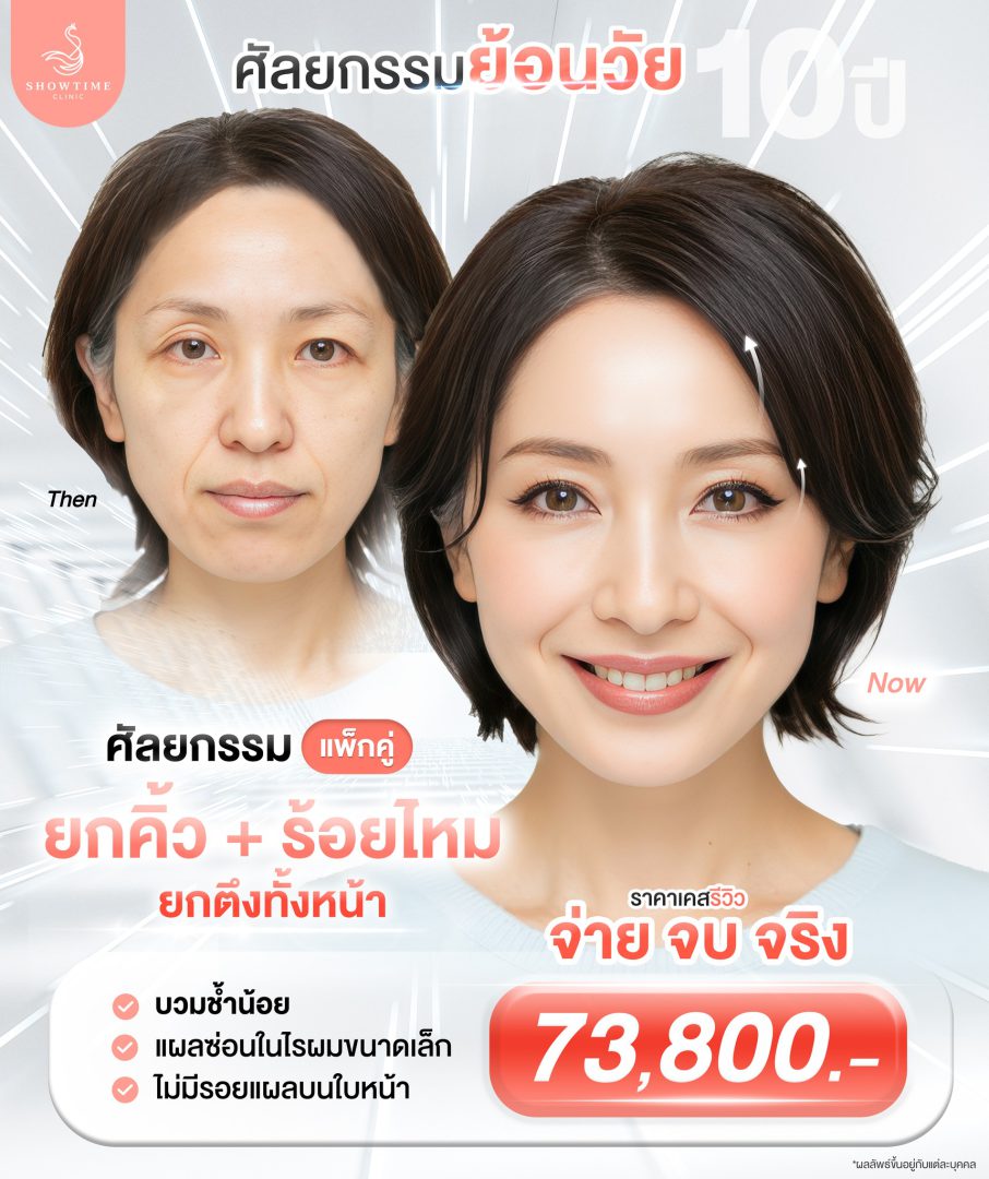 เอนโดไทน์/Endotine