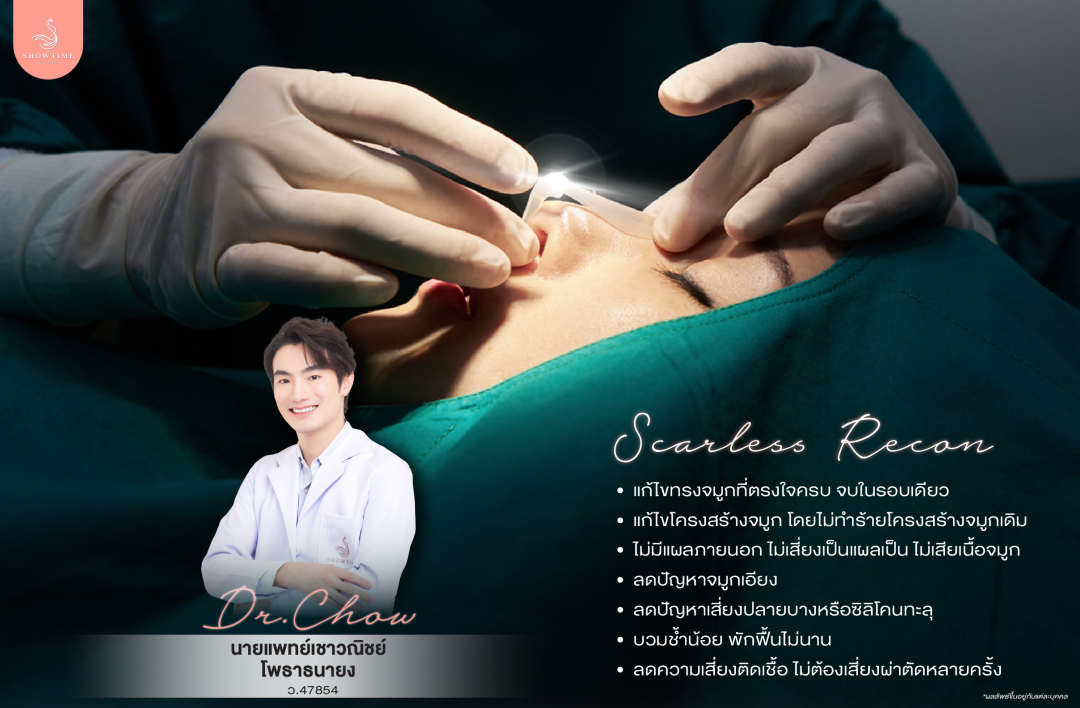 Scarless Recon / Elegant Eyes / เสริมจมูก / ตาสองชั้น