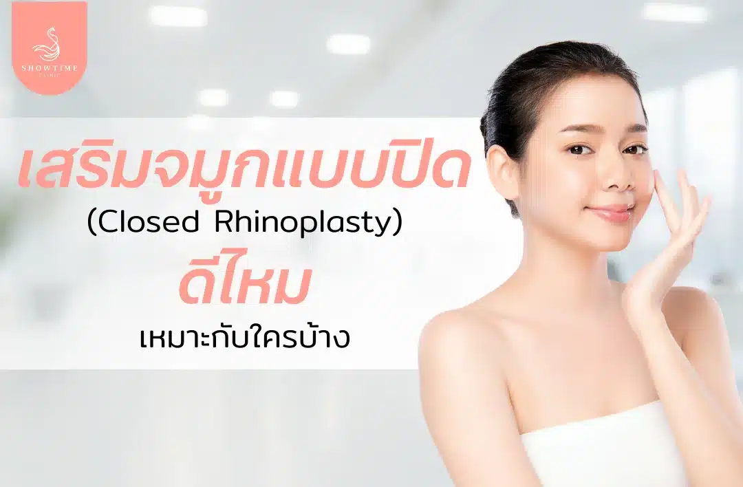 รู้ก่อนทำ เสริมจมูกแบบปิด (Closed) ดีไหม เหมาะกับใครบ้าง