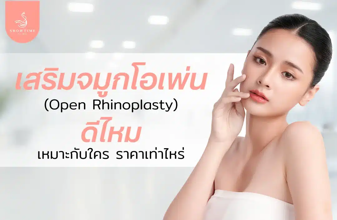 เจาะลึก เสริมจมูกโอเพ่น (Open) ดีไหม เหมาะกับใคร ราคาเท่าไหร่