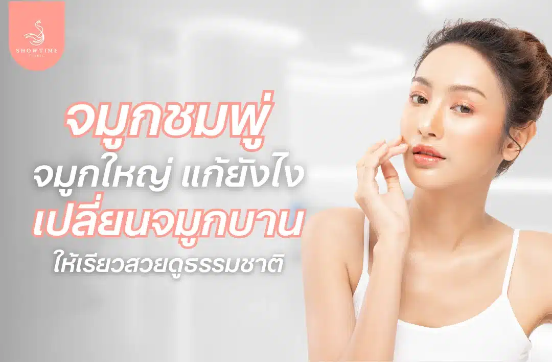 จมูกชมพู่ จมูกใหญ่ แก้ยังไง เปลี่ยนจมูกบานให้เรียวสวยดูธรรมชาติ