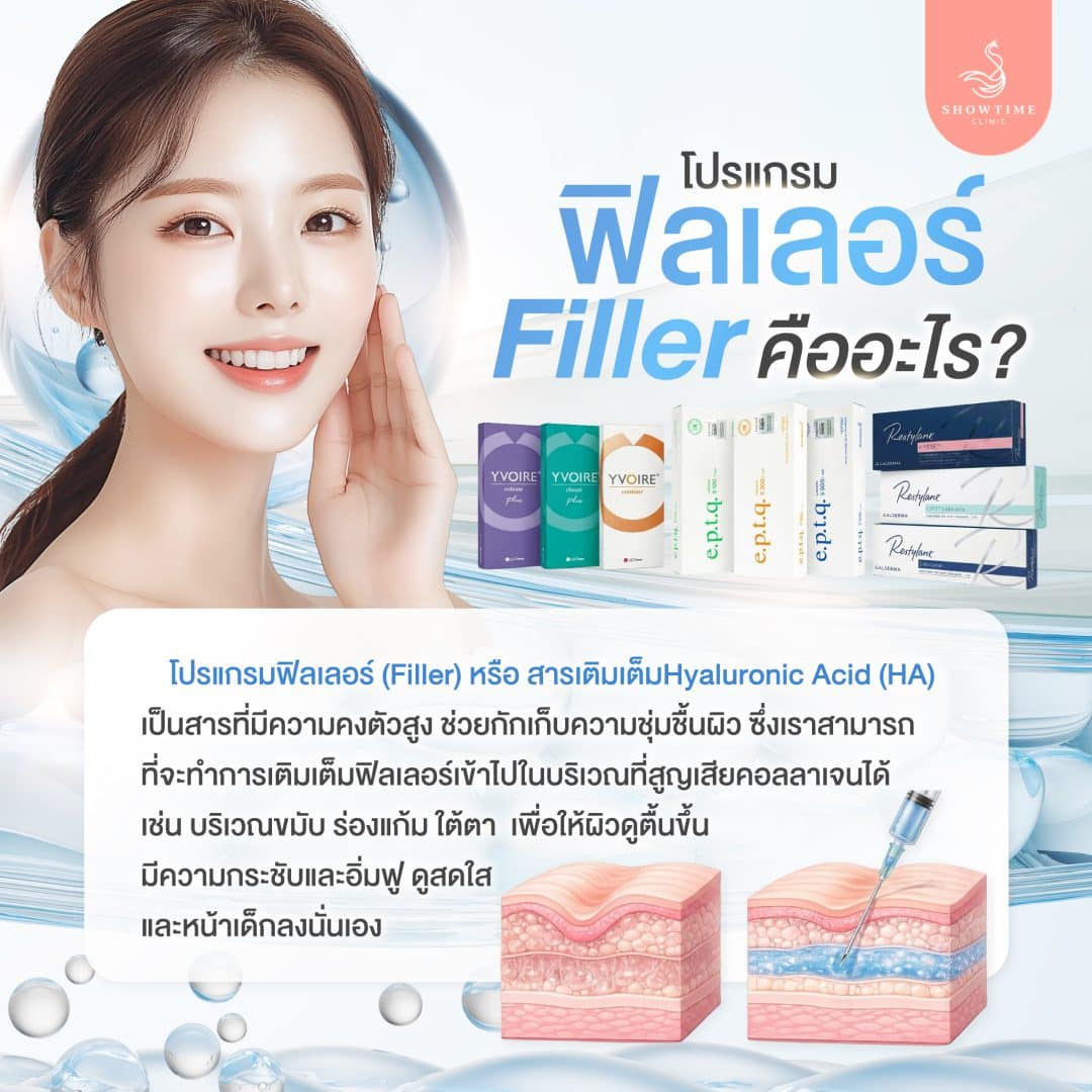 ฟิลเลอร์ (Filler) คืออะไร