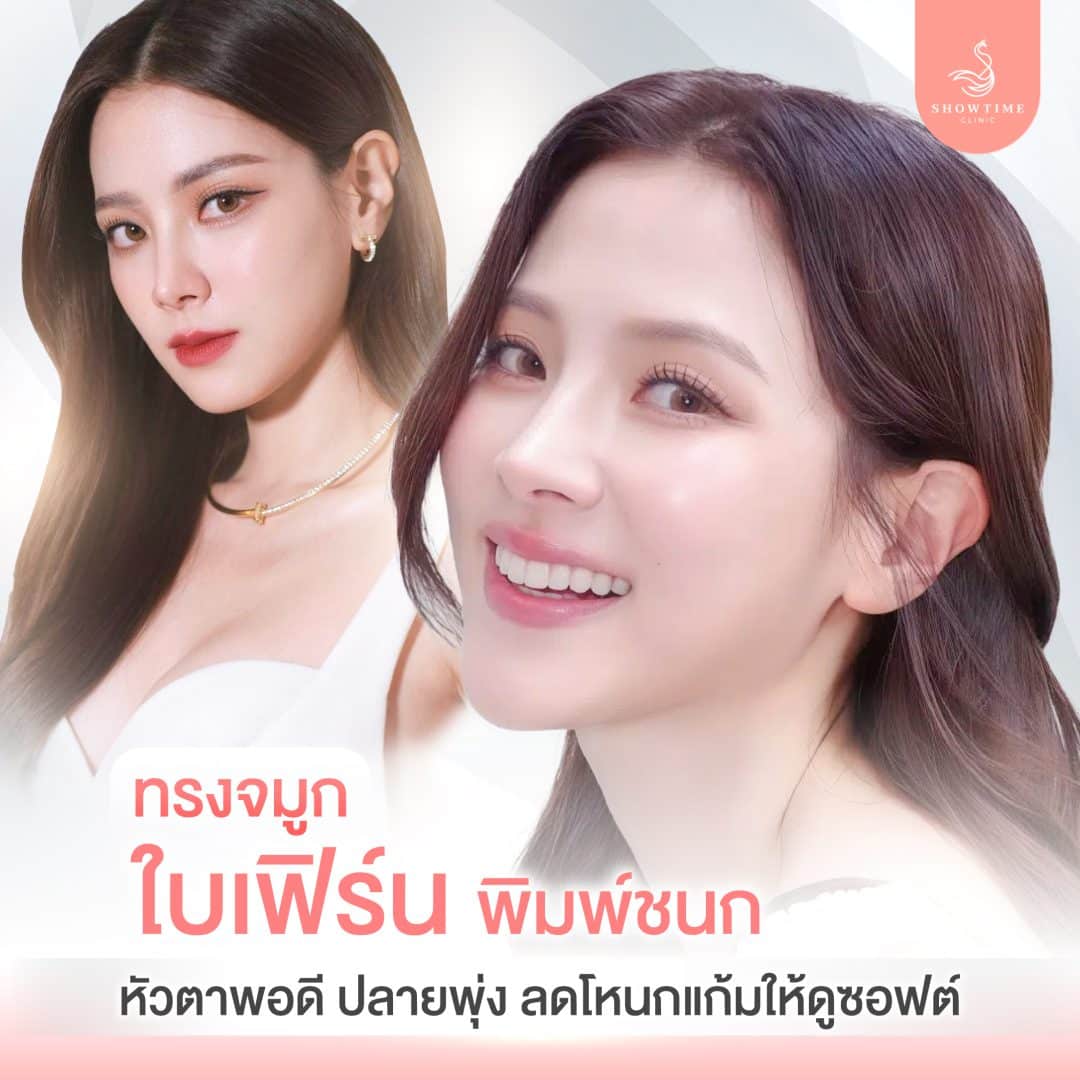 ทรงจมูกใบเฟิร์น พิมพ์ชนก