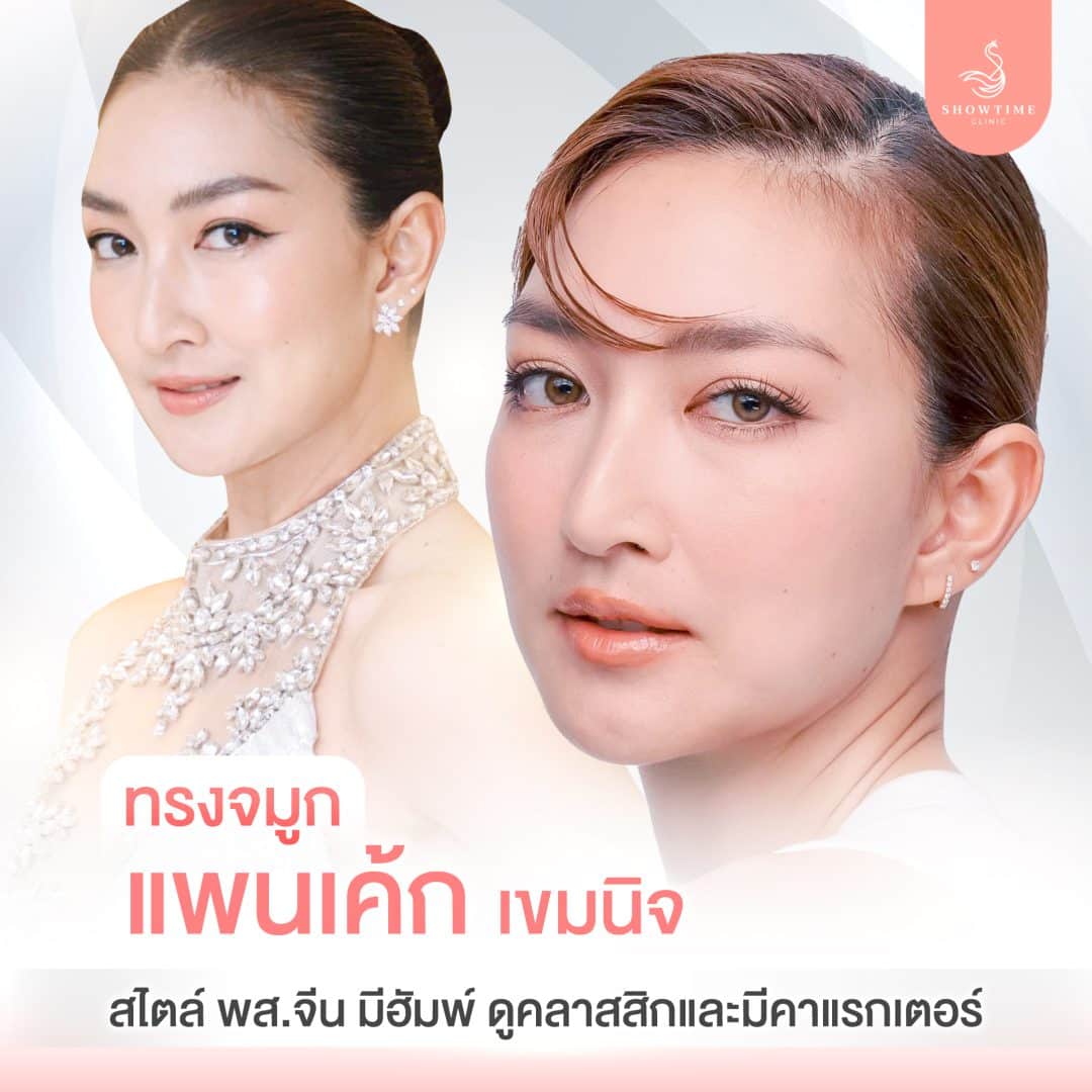 ทรงจมูกแพนเค้ก