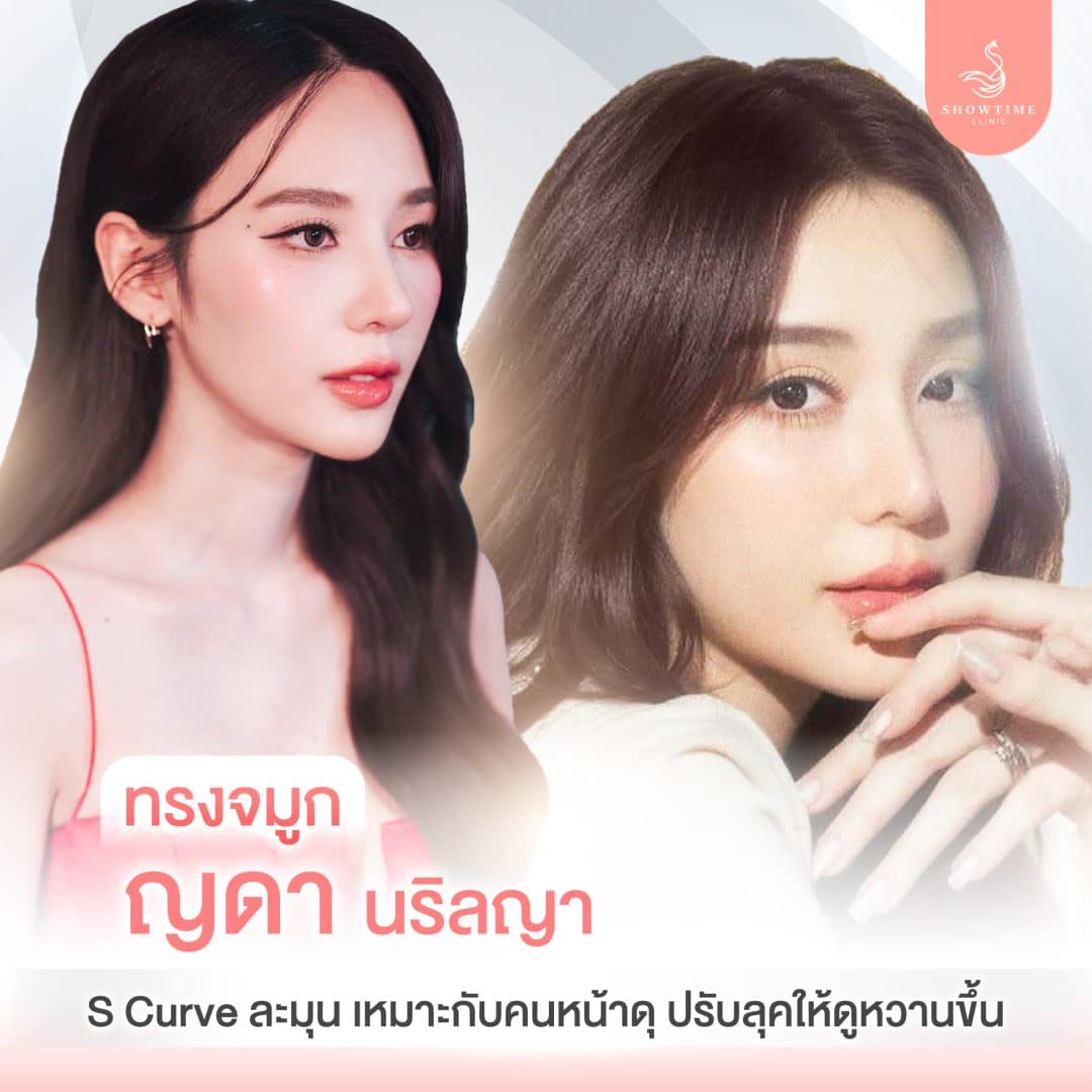 ทรงจมูกญดา