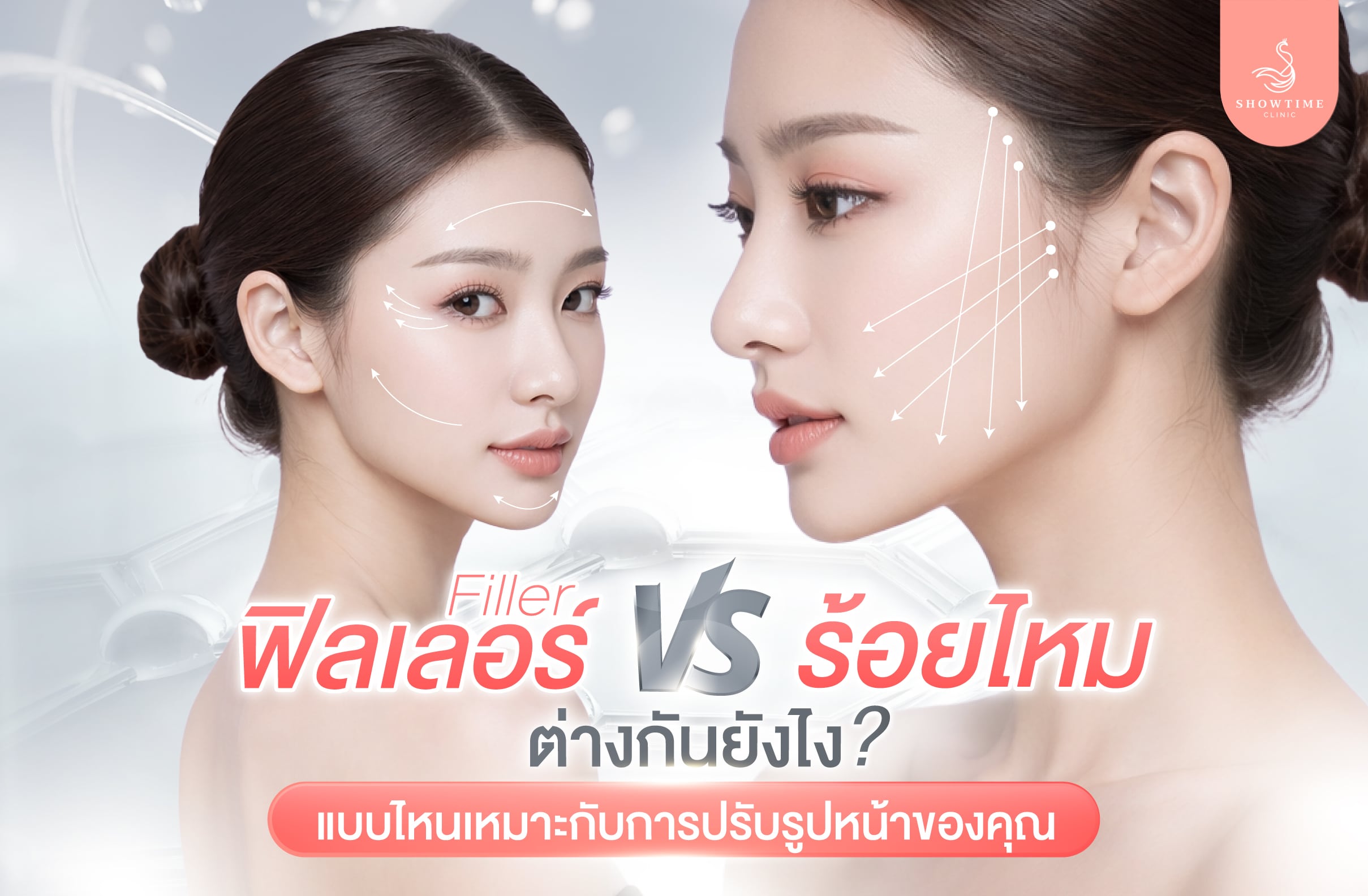 ฟิลเลอร์ vs ร้อยไหม