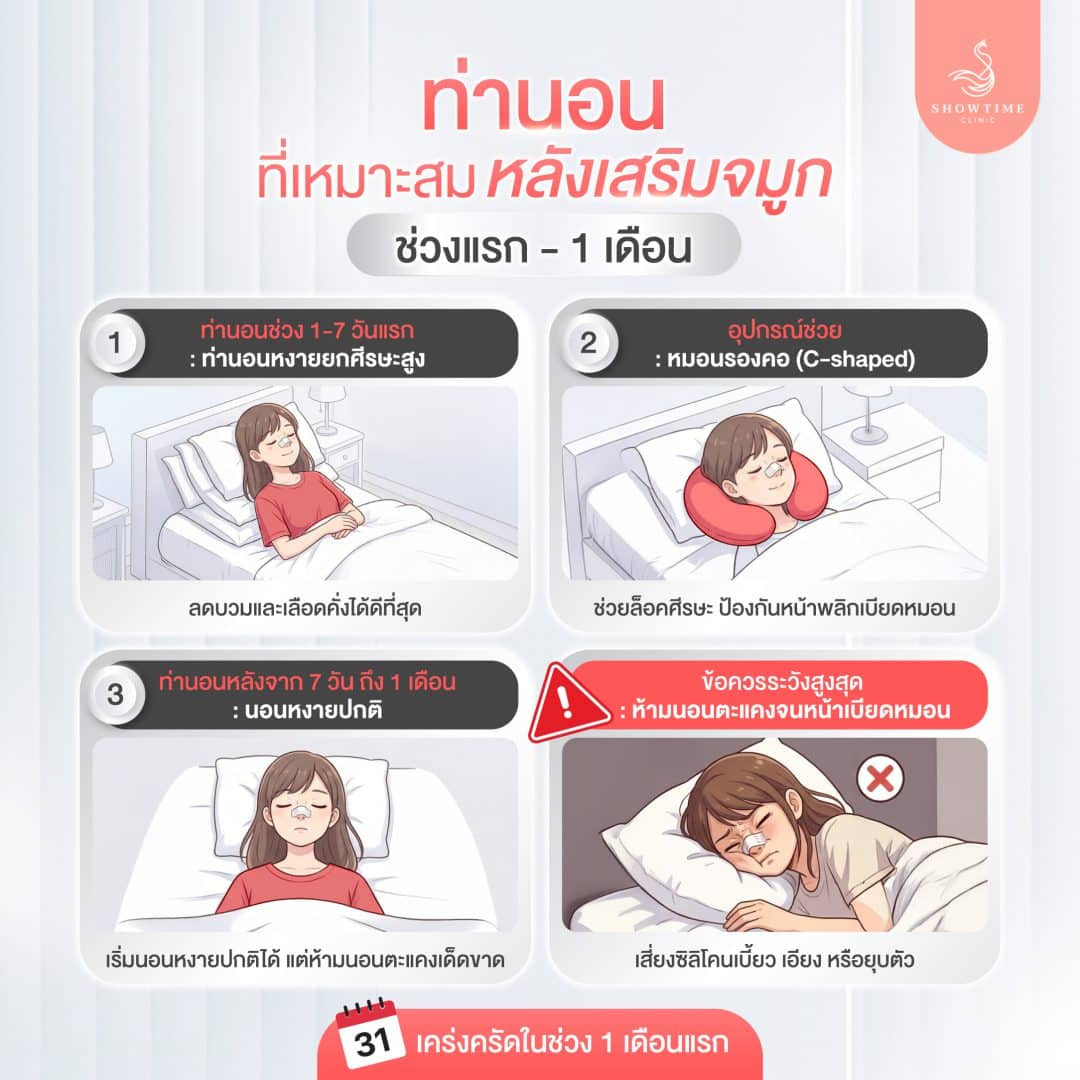 ท่านอน หลังเสริมจมูก