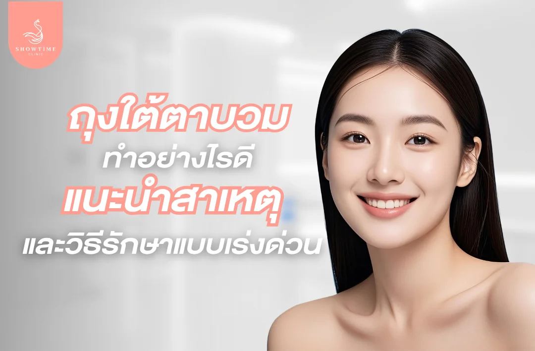 ถุงใต้ตาบวมทำอย่างไรดี แนะนำสาเหตุและวิธีรักษาแบบเร่งด่วน