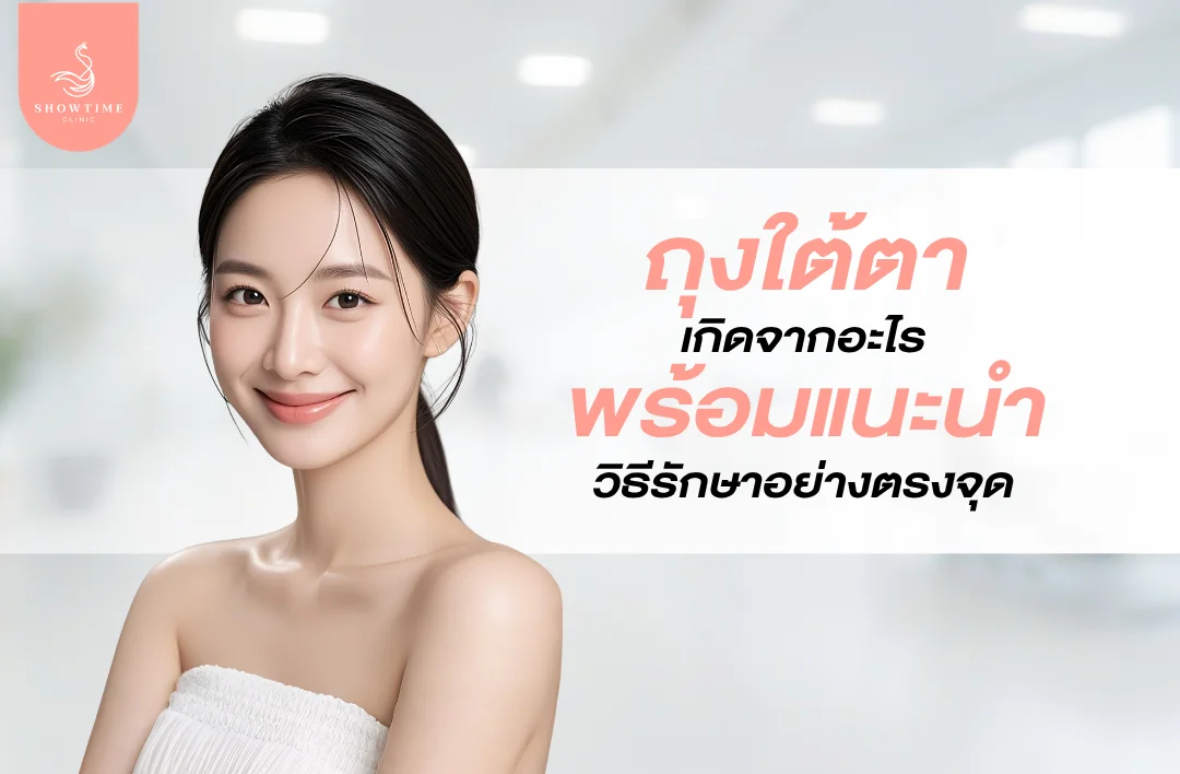 ถุงใต้ตาเกิดจากอะไร