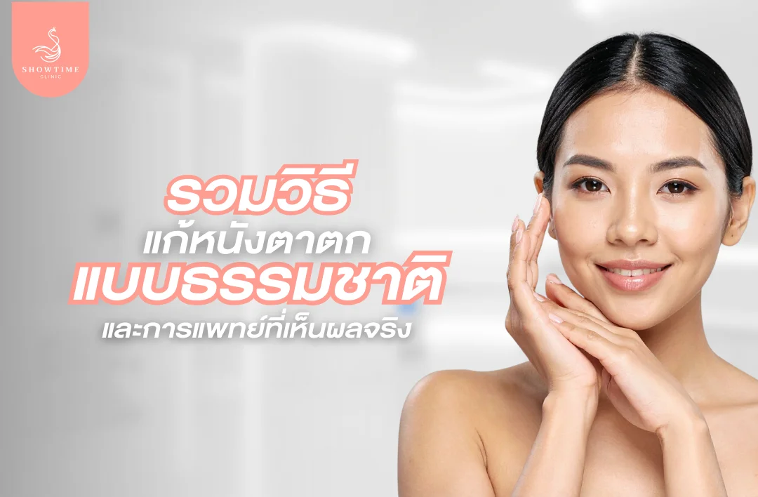รวมวิธีแก้หนังตาตก แบบธรรมชาติและการแพทย์ที่เห็นผลจริง