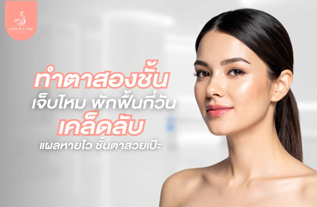 ทำตาสองชั้นเจ็บไหม พักฟื้นกี่วัน