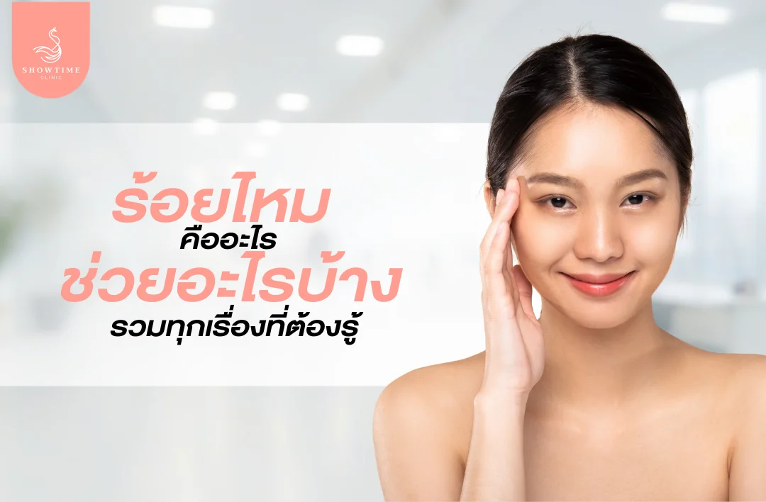 ร้อยไหมคืออะไร ช่วยเรื่องอะไรบ้าง รวมทุกเรื่องที่ต้องรู้