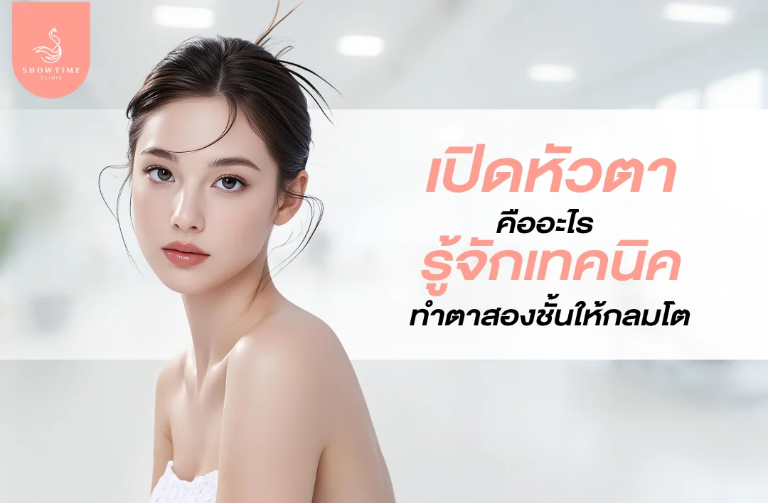 การเปิดหัวตาคืออะไร