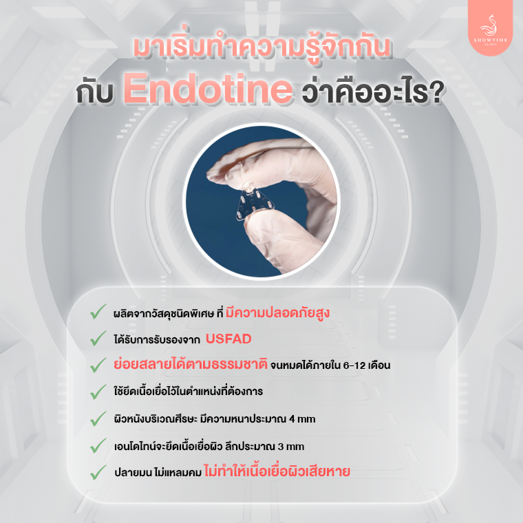 Endotine