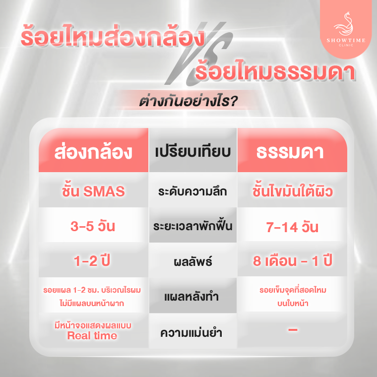 ร้อยไหมส่องกล้อง vs ร้อยไหมปกติ