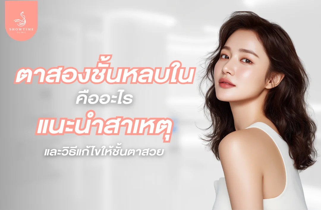 ตาสองชั้นหลบในคืออะไร