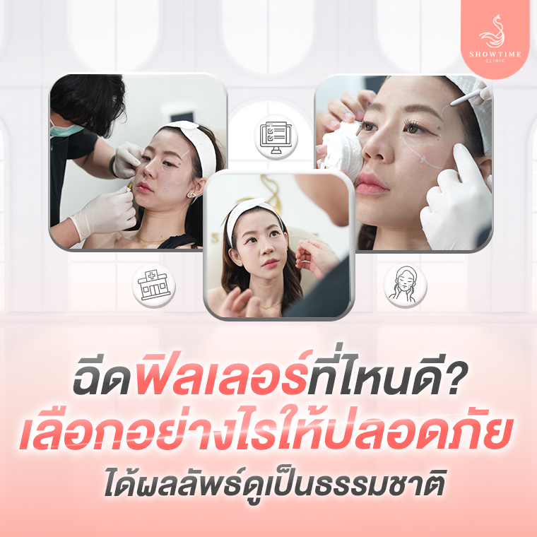 ฉีดฟิลเลอร์ที่ไหนดี ปลอดภัย ผลลัพธ์เป็นธรรมชาติ