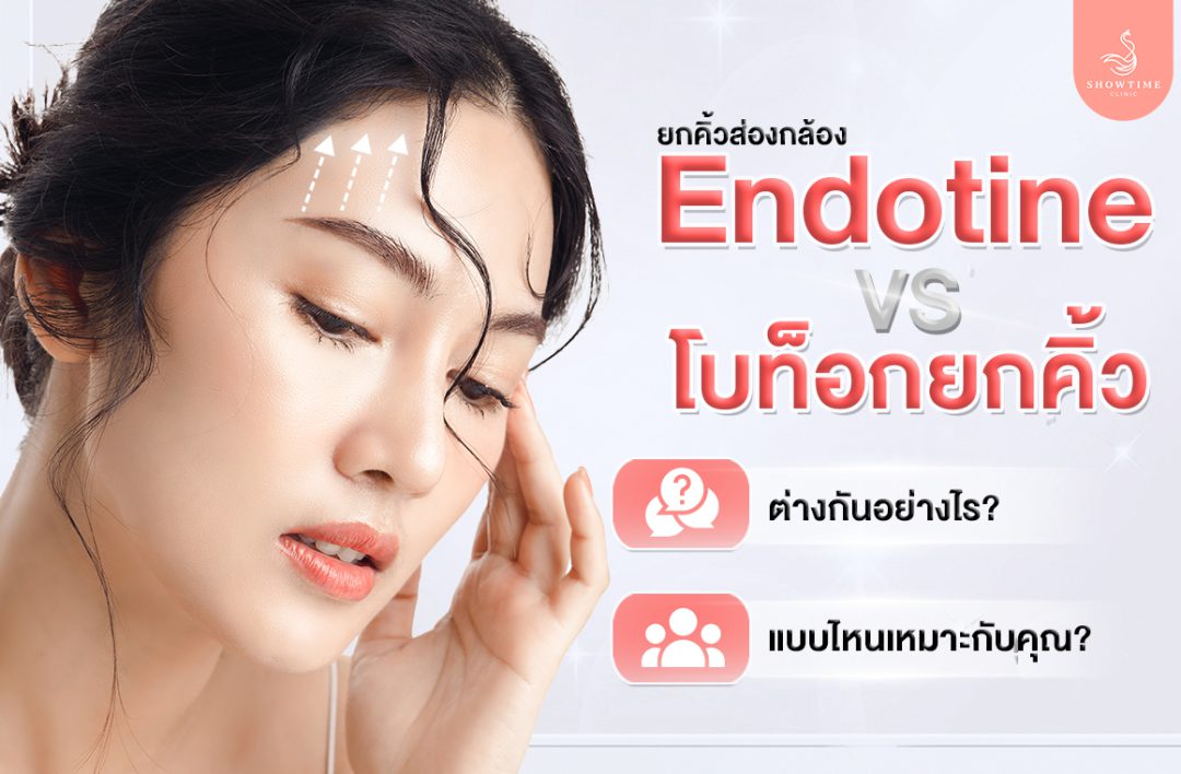 ยกคิ้วส่องกล้อง Endotine vs โบท็อกยกคิ้ว
