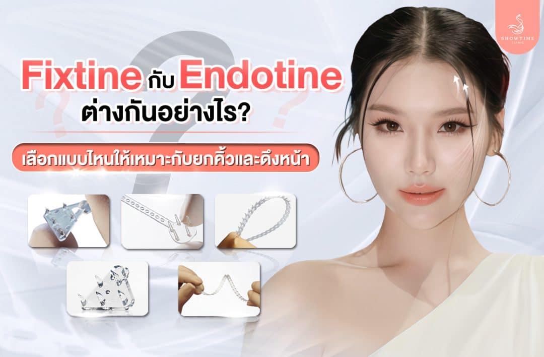 Fixtine vs Endotine