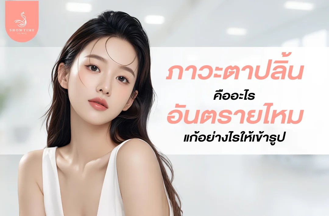 ภาวะตาปลิ้นคืออะไร