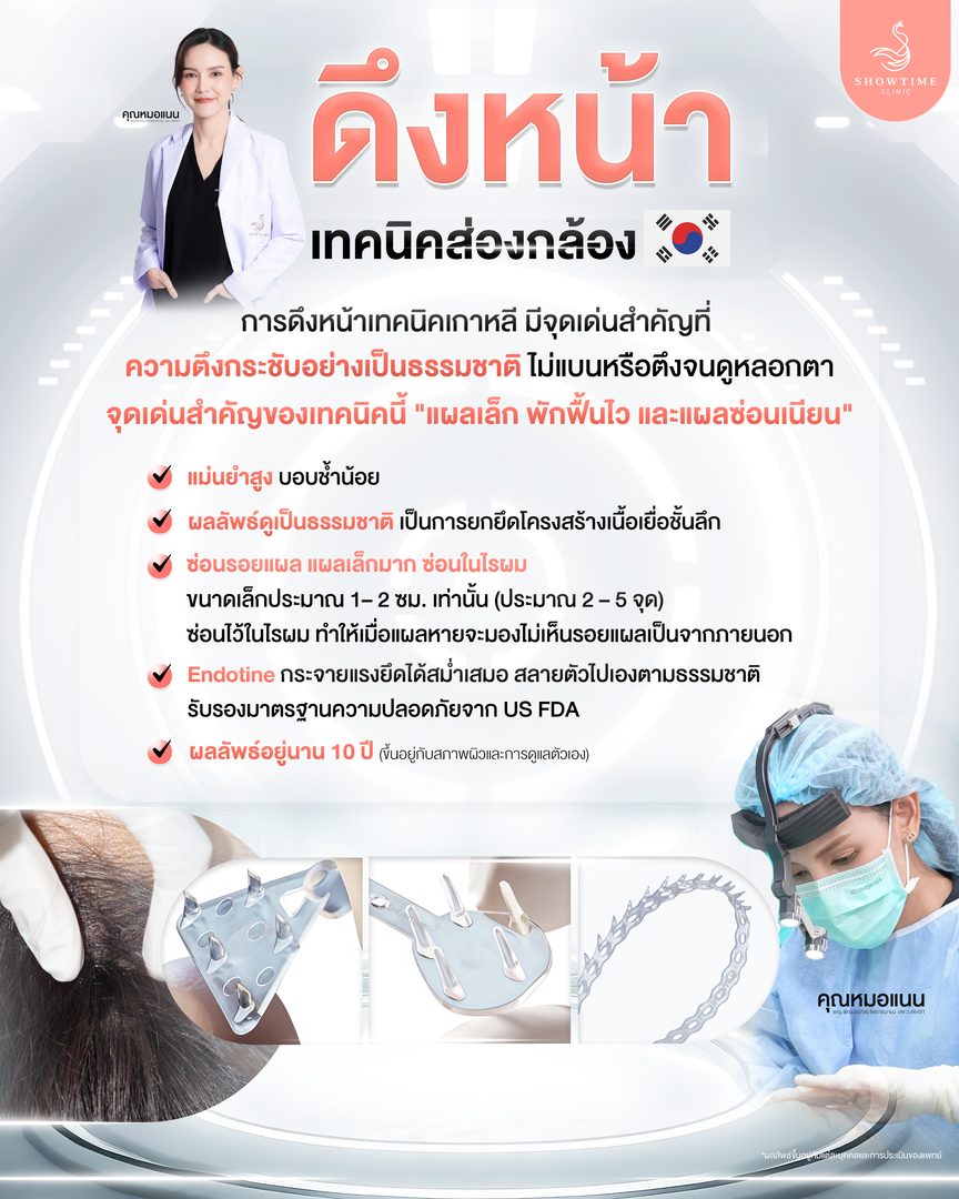ดึงหน้าเทคนิคส่องกล้อง