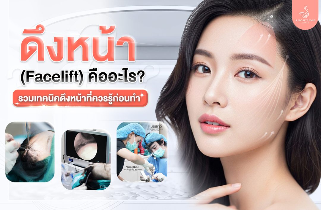 Facelift ดึงหน้า