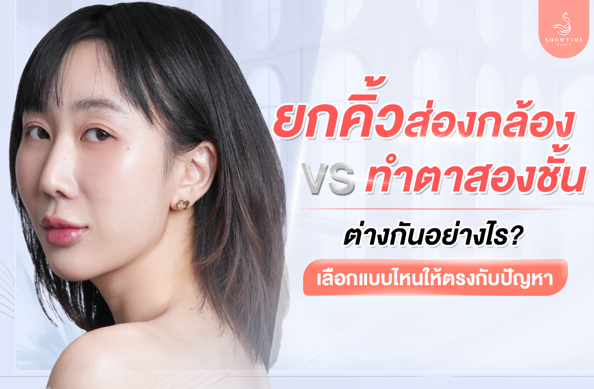 ยกคิ้วส่องกล้อง vs ตาสองชั้น
