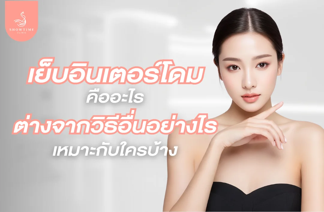 เย็บอินเตอร์โดมคืออะไร