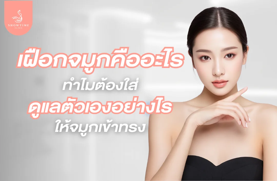 เฝือกจมูกคืออะไร ทำไมต้องใส่
