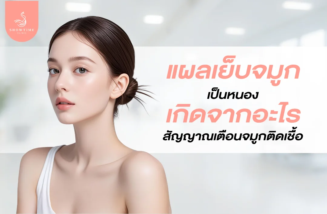 แผลเย็บจมูกเป็นหนอง เกิดจากอะไร