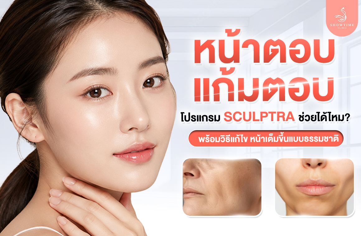 Sculptra แก้มตอบ หน้าตอบ
